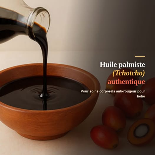Huile de Palmiste Noire (Tchotcho) Pure – Soin Apaisant Anti-Rougeurs pour Bébé (1L)